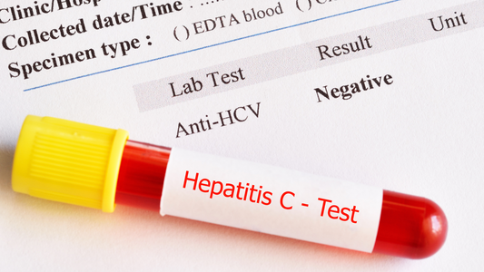 A Summary Of Chronic Hepatitis C Infection