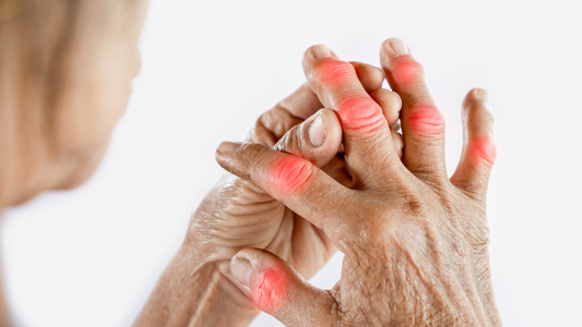 Arthritis: Its Debilitating and Detrimental Effects